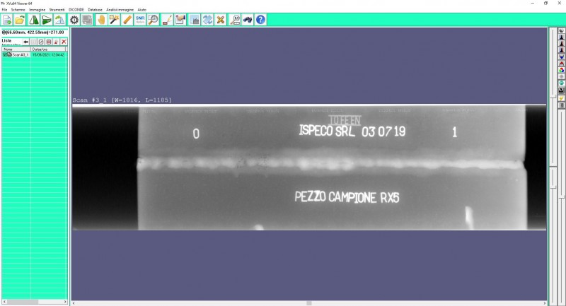 Digitalizzazione film radiografici