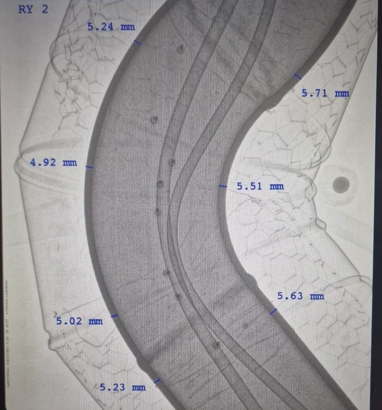 Computer radiography - CR